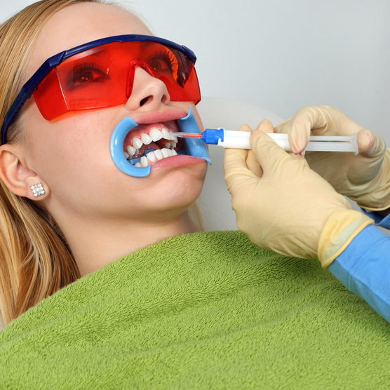 безопасное отбеливание зубов в стоматологии цена в