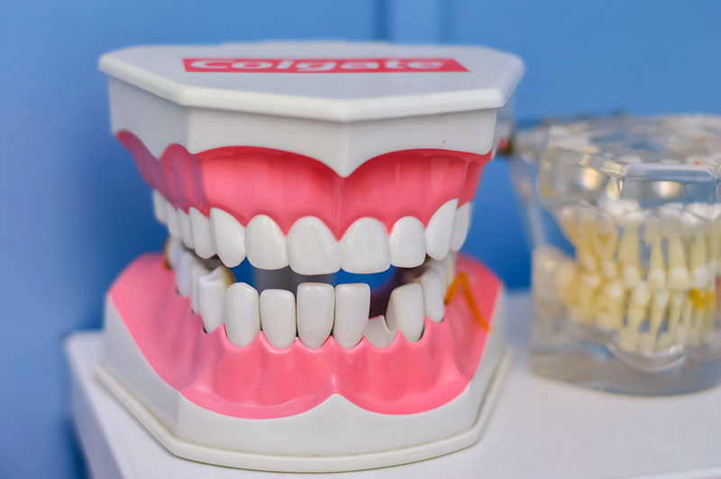 Принцип классической имплантации зубов