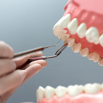 Имплантация одного зуба - этапы имплантации зуба.