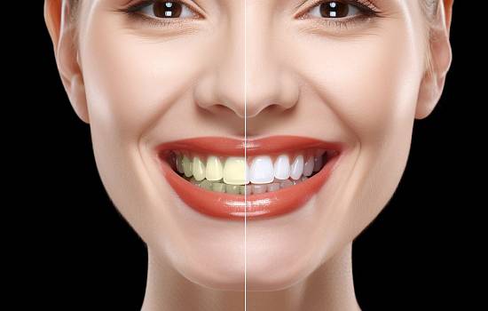 Есть ли противопоказания к отбеливанию зубов