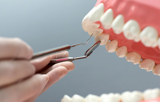 Имплантация одного зуба - этапы имплантации зуба.