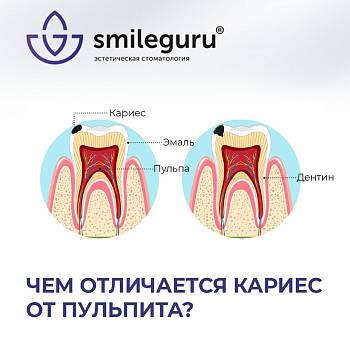 Зуб состоит из эмали, дентина